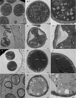 Integrated transcriptomic and proteomic analysis of a cytoplasmic male sterility line and associated maintainer line in soybean